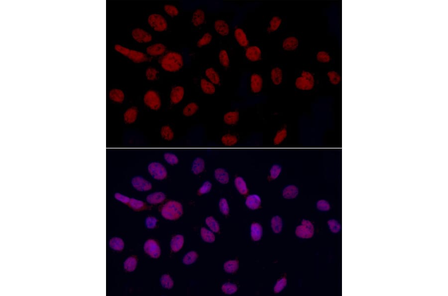 Immunofluorescence - Anti-GAS41 Antibody (A15170) - Antibodies.com
