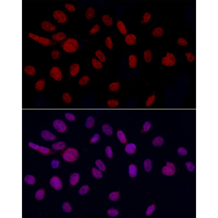 Immunofluorescence - Anti-GAS41 Antibody (A15170) - Antibodies.com