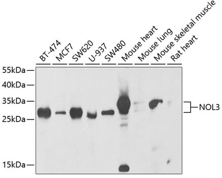 Western blot analysis of extracts of various cell lines, using Anti-NOL3 Antibody (A6319) at 1:1,000 dilution.
Secondary antibody: Goat Anti-Rabbit IgG (H+L) (HRP) (AS014) at 1:10,000 dilution.
Lysates / proteins: 25µg per lane.
Blocking buffer: 3% non-fat dry milk in TBST.
Detection: ECL Enhanced Kit (RM00021).
Exposure time: 30s.