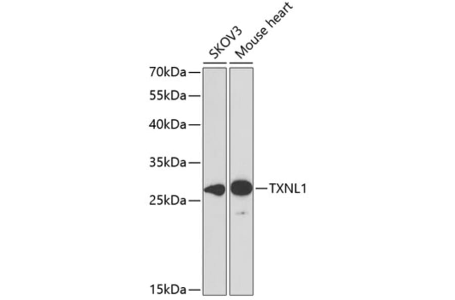 Western Blot - Anti-TXNL1 Antibody (A6322) - Antibodies.com