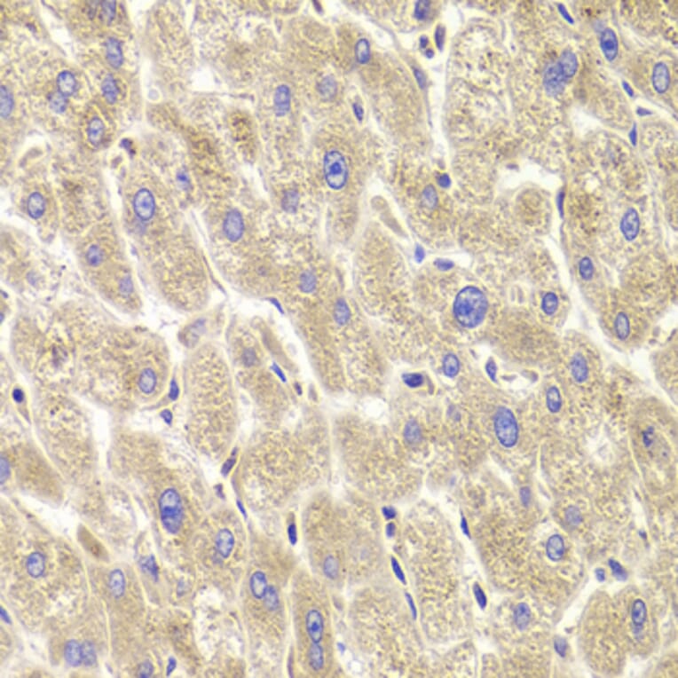 Immunohistochemistry - Anti-TXNL1 Antibody (A6322) - Antibodies.com