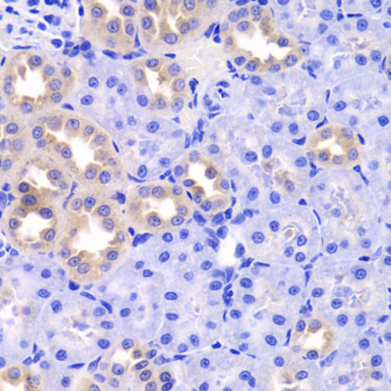 Immunohistochemistry - Anti-TXNL1 Antibody (A6322) - Antibodies.com