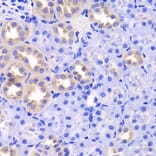 Immunohistochemistry - Anti-TXNL1 Antibody (A6322) - Antibodies.com