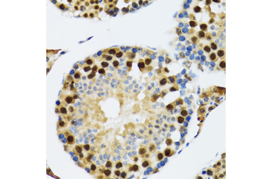 Immunohistochemistry - Anti-TXNL1 Antibody (A6322) - Antibodies.com