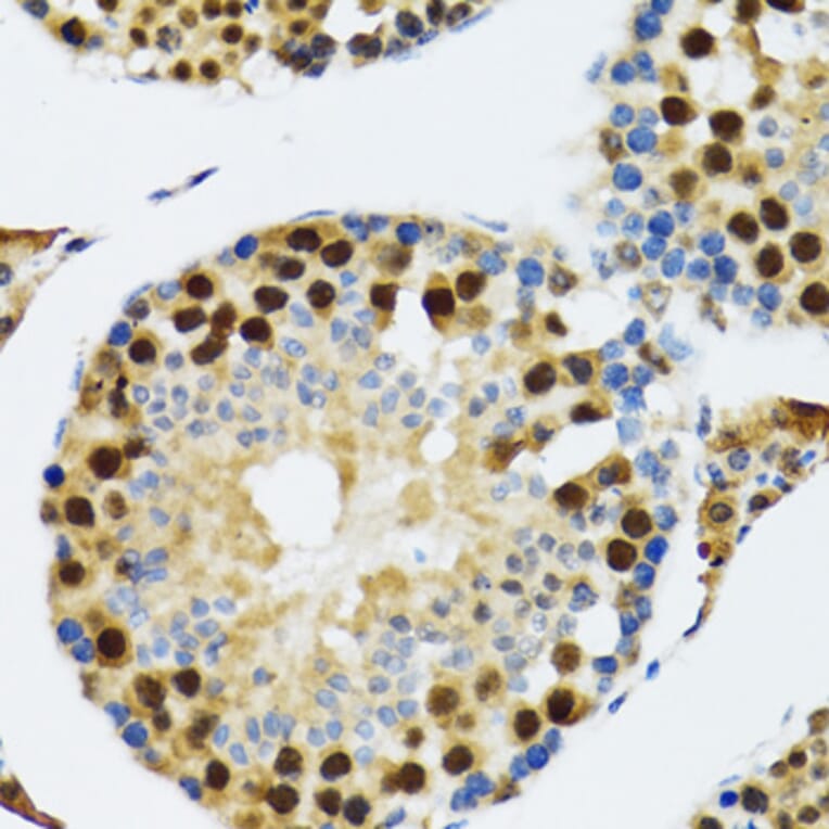 Immunohistochemistry - Anti-TXNL1 Antibody (A6322) - Antibodies.com
