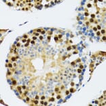 Immunohistochemistry - Anti-TXNL1 Antibody (A6322) - Antibodies.com