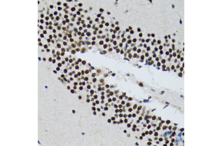 Immunohistochemistry - Anti-TXNL1 Antibody (A6322) - Antibodies.com