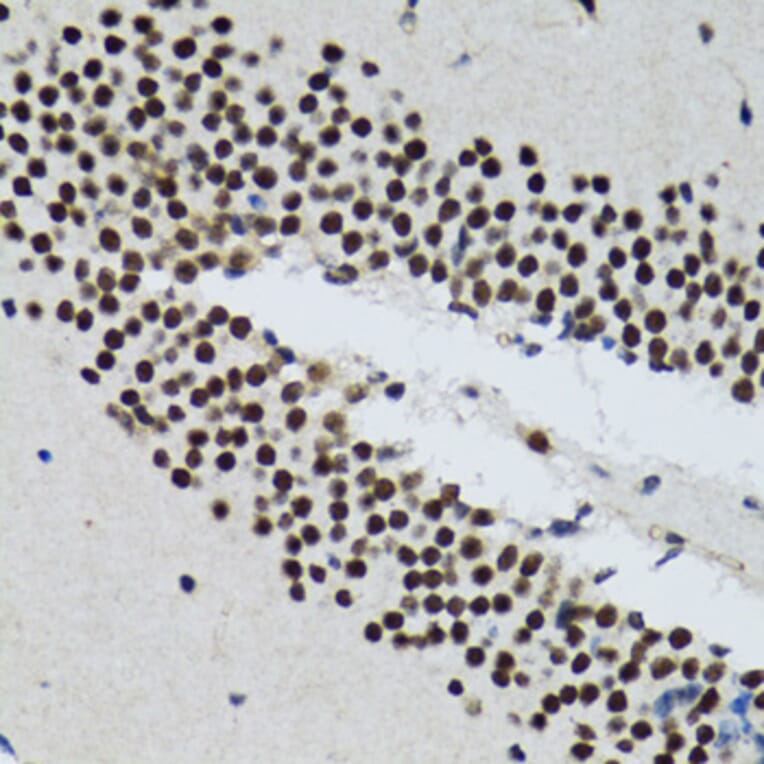 Immunohistochemistry - Anti-TXNL1 Antibody (A6322) - Antibodies.com