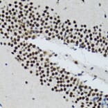 Immunohistochemistry - Anti-TXNL1 Antibody (A6322) - Antibodies.com