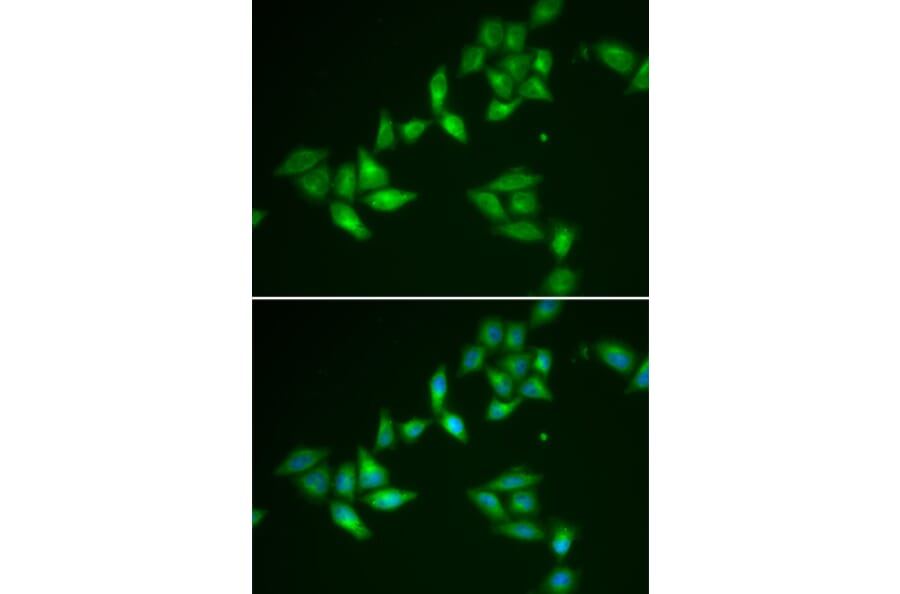 Immunofluorescence - Anti-TXNL1 Antibody (A6322) - Antibodies.com