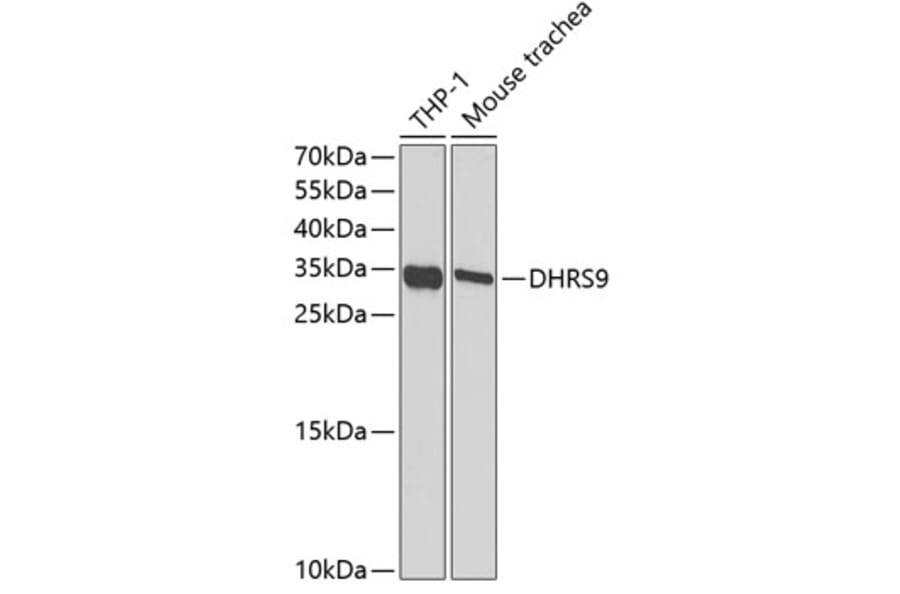 Western Blot - Anti-DHRS9 Antibody (A15173) - Antibodies.com