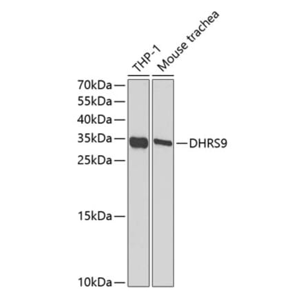 Western Blot - Anti-DHRS9 Antibody (A15173) - Antibodies.com
