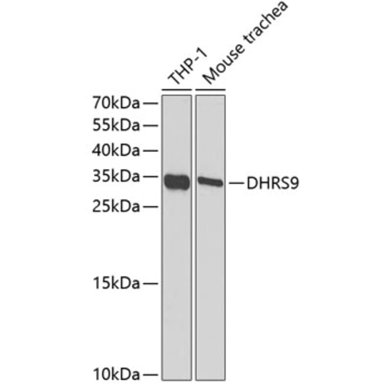 Western Blot - Anti-DHRS9 Antibody (A15173) - Antibodies.com