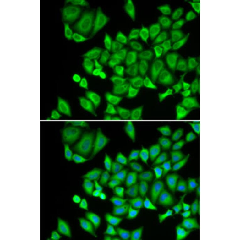 Immunofluorescence - Anti-DHRS9 Antibody (A15173) - Antibodies.com