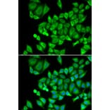 Immunofluorescence - Anti-DHRS9 Antibody (A15173) - Antibodies.com