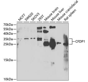 Western Blot - Anti-CFDP1 Antibody (A15174) - Antibodies.com