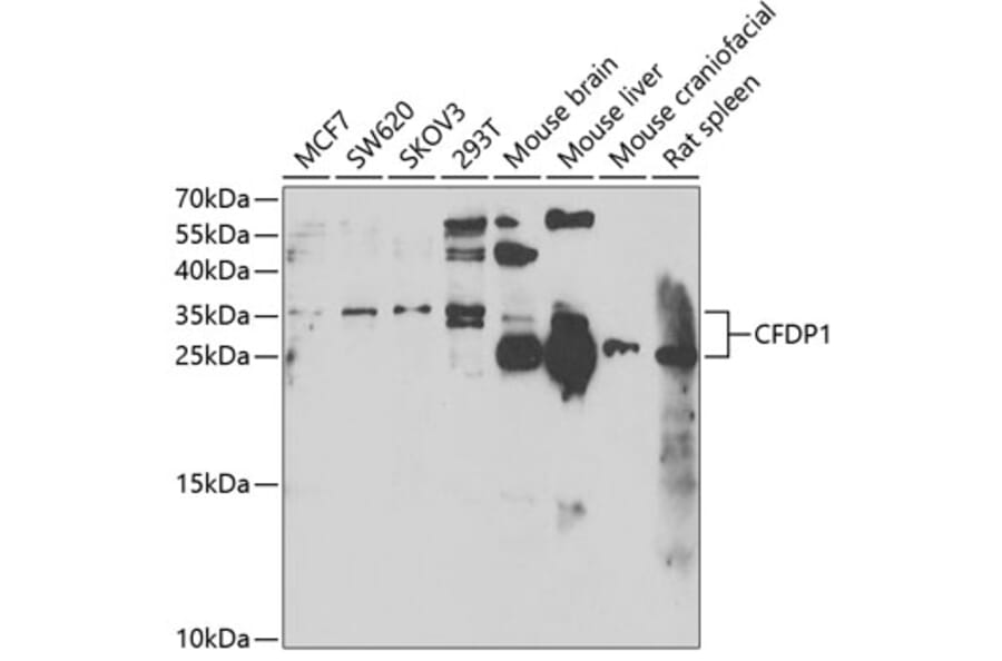 Western Blot - Anti-CFDP1 Antibody (A6325) - Antibodies.com
