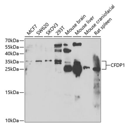Western Blot - Anti-CFDP1 Antibody (A15174) - Antibodies.com