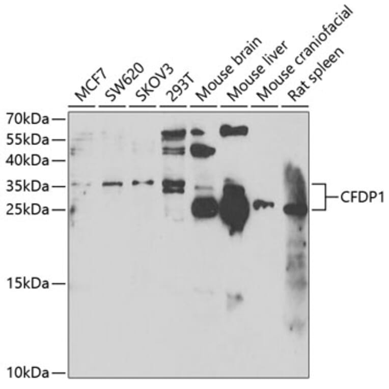 Western Blot - Anti-CFDP1 Antibody (A6325) - Antibodies.com