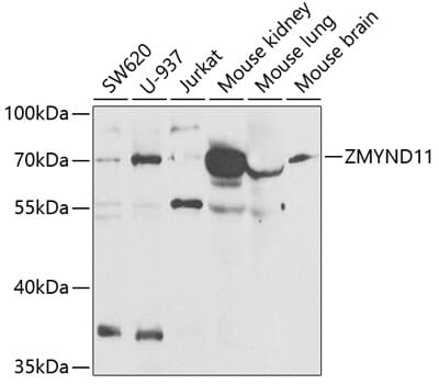 Western blot analysis of extracts of various cell lines, using Anti-ZMYND11 Antibody (A6327) at 1:1,000 dilution.
Secondary antibody: Goat Anti-Rabbit IgG (H+L) (HRP) (AS014) at 1:10,000 dilution.
Lysates / proteins: 25µg per lane.
Blocking buffer: 3% non-fat dry milk in TBST.
Detection: ECL Basic Kit (RM00020).
Exposure time: 90s.