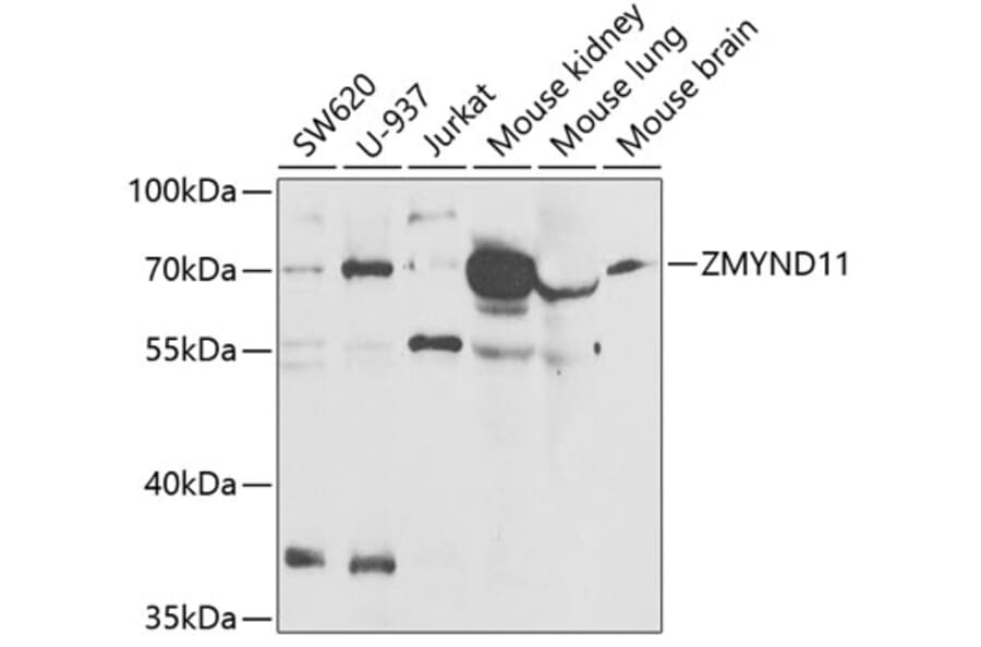 Western Blot - Anti-BS69 Antibody (A15175) - Antibodies.com