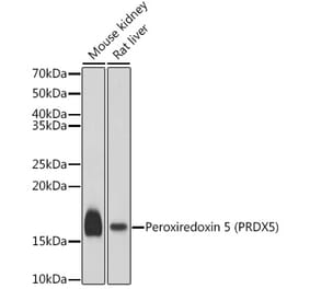 Western Blot - Anti-Peroxiredoxin 5 Antibody (A15176) - Antibodies.com