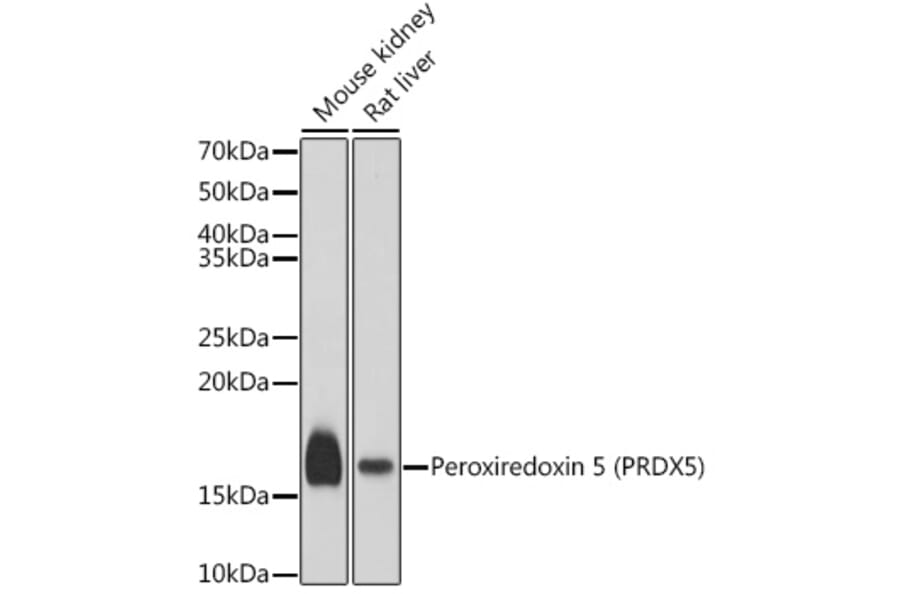 Western Blot - Anti-Peroxiredoxin 5 Antibody (A15176) - Antibodies.com