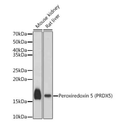 Western Blot - Anti-Peroxiredoxin 5 Antibody (A15176) - Antibodies.com