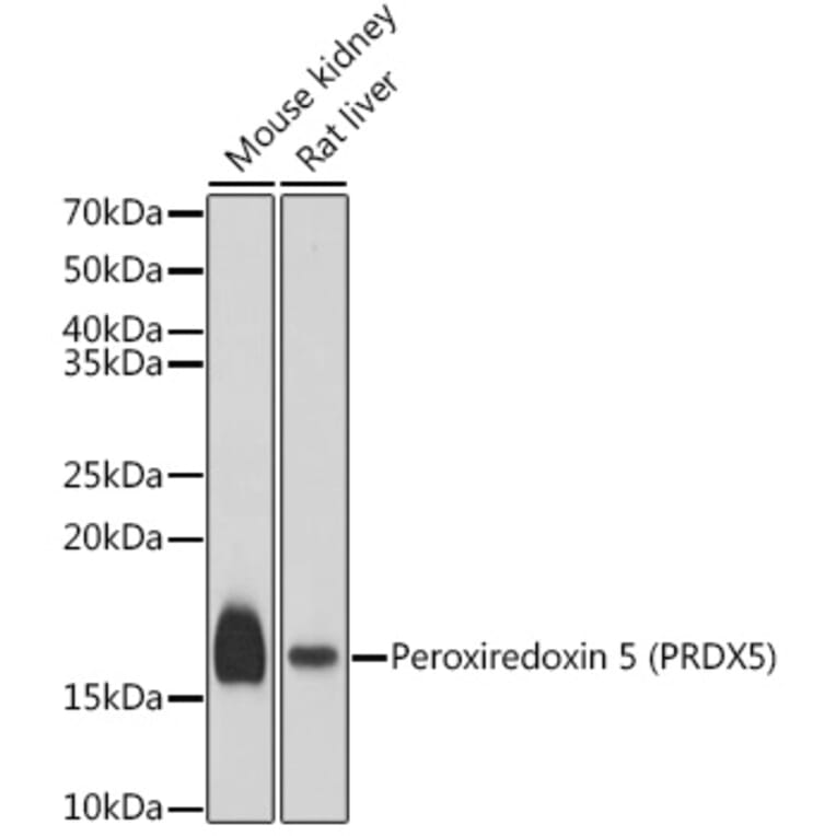 Western Blot - Anti-Peroxiredoxin 5 Antibody (A15176) - Antibodies.com