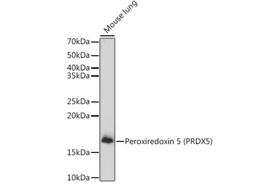 Western Blot - Anti-Peroxiredoxin 5 Antibody (A15176) - Antibodies.com