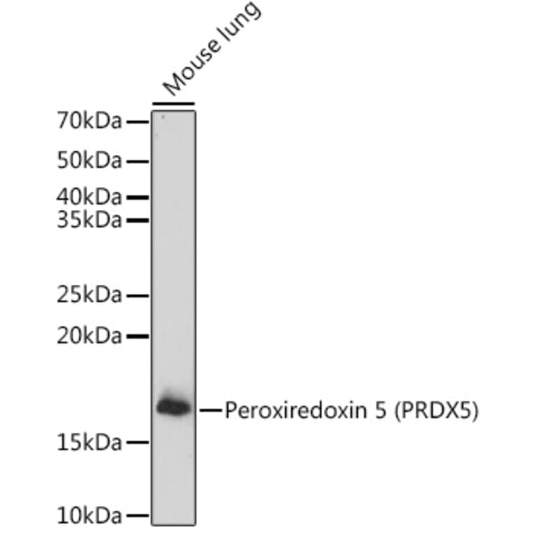 Western Blot - Anti-Peroxiredoxin 5 Antibody (A15176) - Antibodies.com