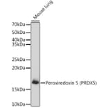 Western Blot - Anti-Peroxiredoxin 5 Antibody (A15176) - Antibodies.com
