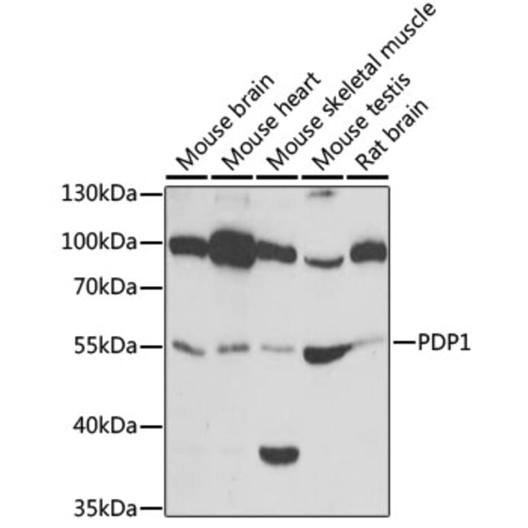 Western Blot - Anti-PDP1/PDP Antibody (A15177) - Antibodies.com