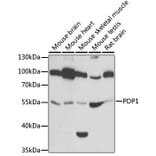 Western Blot - Anti-PDP1/PDP Antibody (A15177) - Antibodies.com