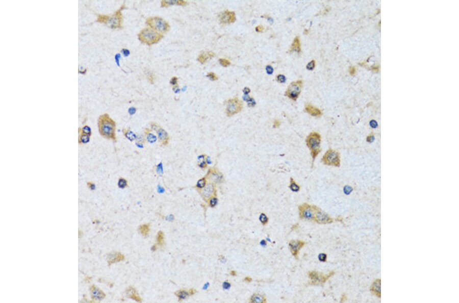 Immunohistochemistry - Anti-PDP1/PDP Antibody (A15177) - Antibodies.com