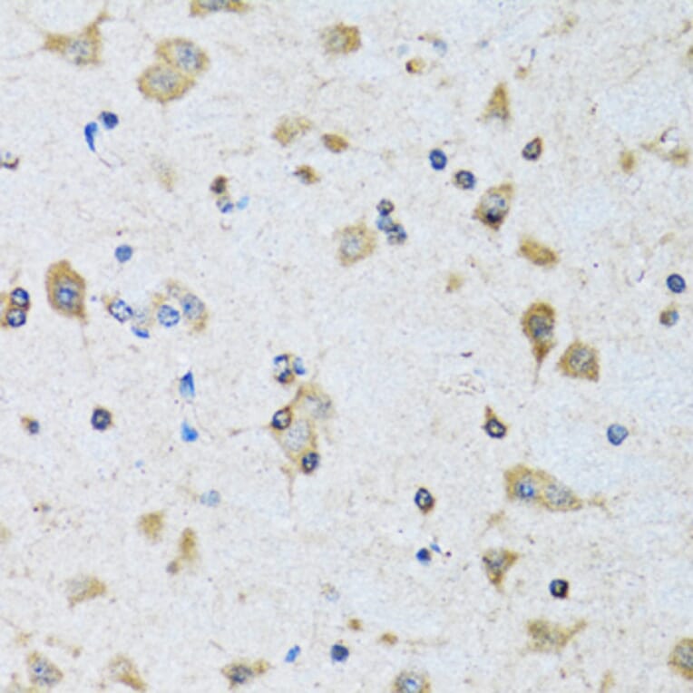 Immunohistochemistry - Anti-PDP1/PDP Antibody (A15177) - Antibodies.com