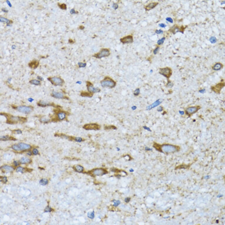 Immunohistochemistry - Anti-PDP1/PDP Antibody (A15177) - Antibodies.com