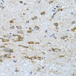 Immunohistochemistry - Anti-PDP1/PDP Antibody (A15177) - Antibodies.com