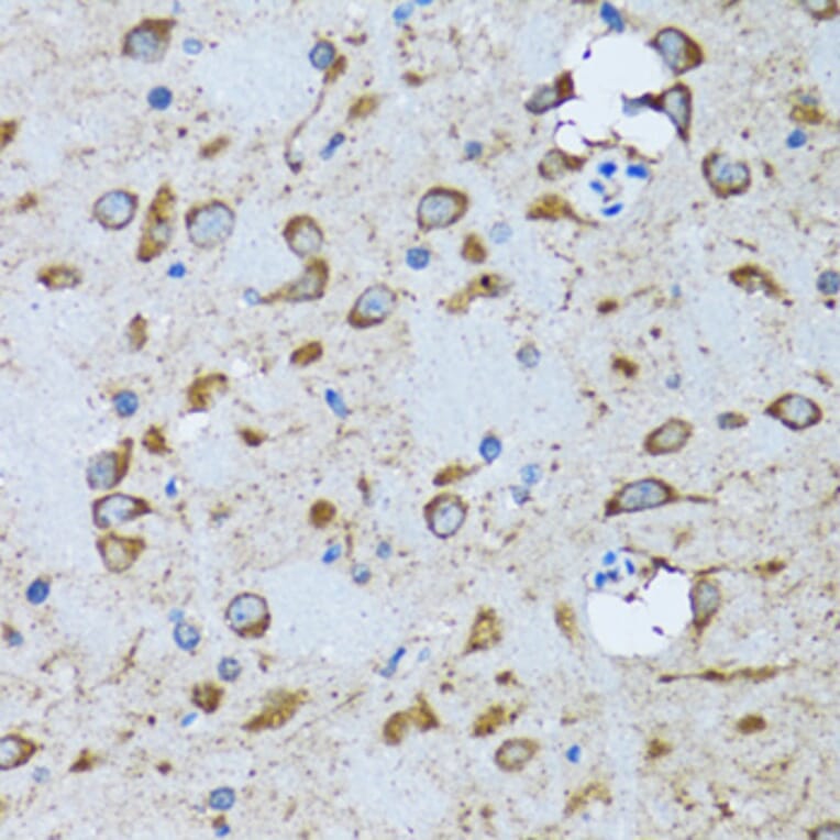 Immunohistochemistry - Anti-PDP1/PDP Antibody (A15177) - Antibodies.com
