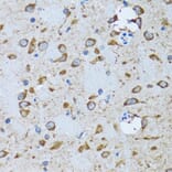 Immunohistochemistry - Anti-PDP1/PDP Antibody (A15177) - Antibodies.com