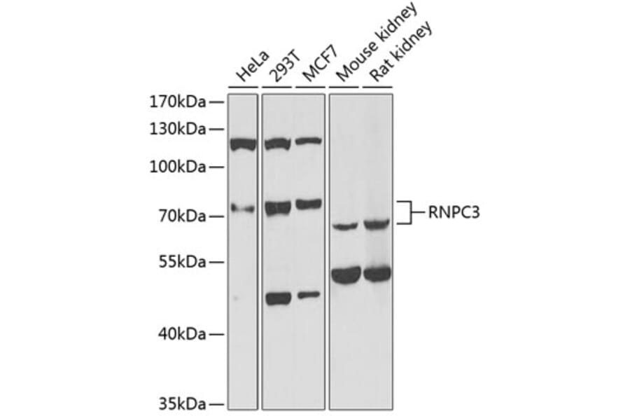 Western Blot - Anti-RNPC3 Antibody (A6333) - Antibodies.com