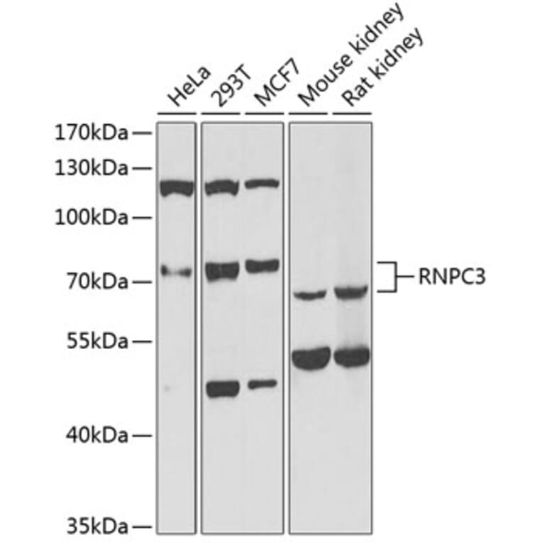 Western Blot - Anti-RNPC3 Antibody (A6333) - Antibodies.com