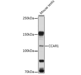 Western Blot - Anti-DIS Antibody (A15179) - Antibodies.com