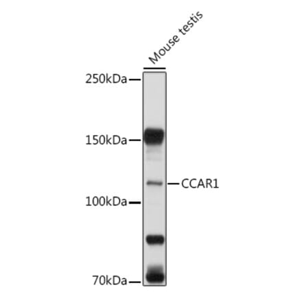 Western Blot - Anti-DIS Antibody (A15179) - Antibodies.com