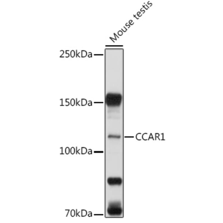 Western Blot - Anti-DIS Antibody (A15179) - Antibodies.com