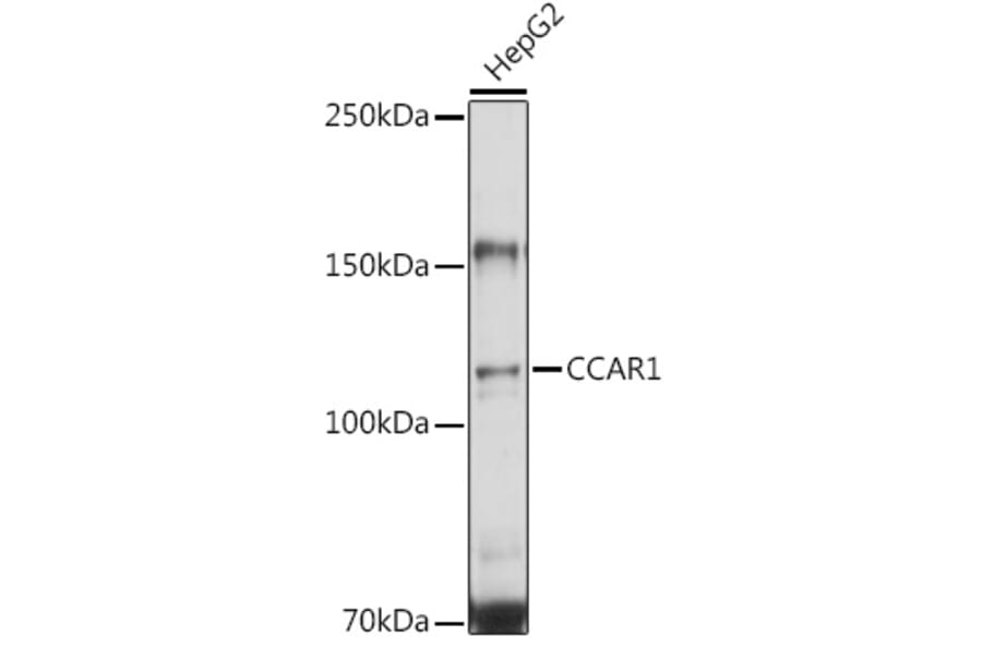 Western Blot - Anti-DIS Antibody (A15179) - Antibodies.com