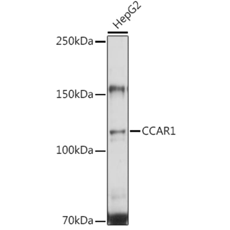 Western Blot - Anti-DIS Antibody (A15179) - Antibodies.com
