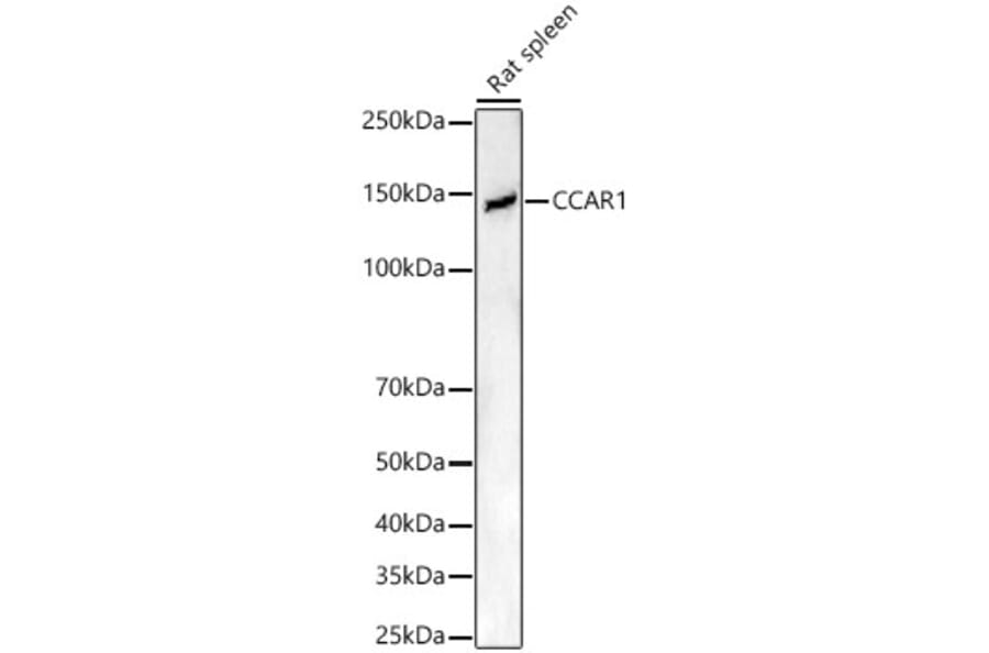 Western Blot - Anti-DIS Antibody (A15179) - Antibodies.com