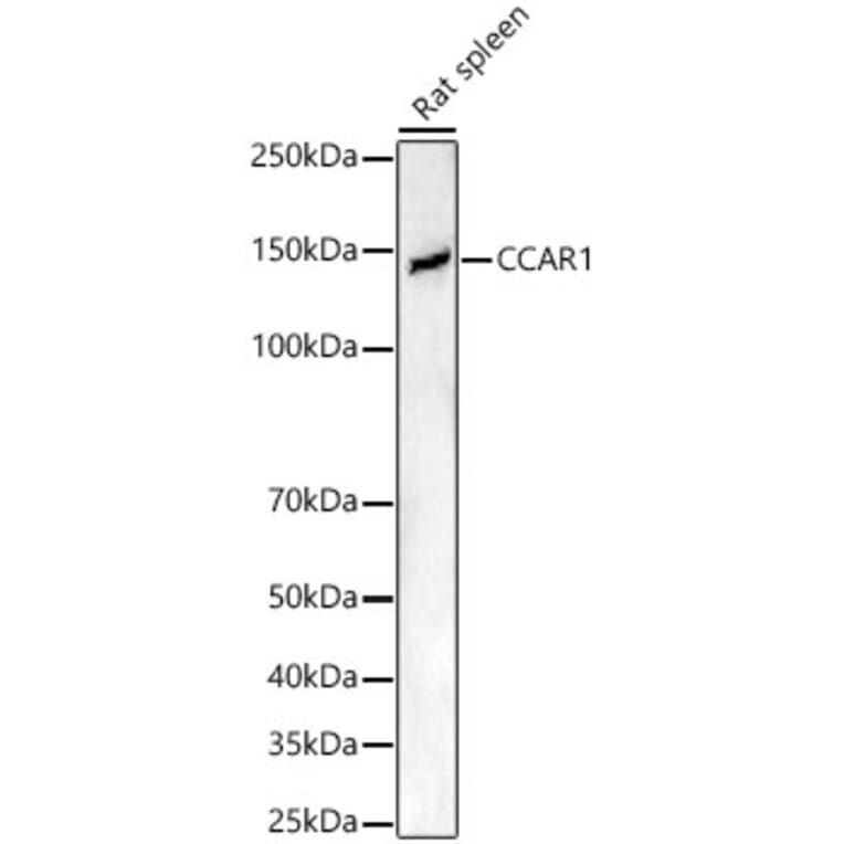 Western Blot - Anti-DIS Antibody (A15179) - Antibodies.com