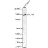 Western Blot - Anti-DIS Antibody (A15179) - Antibodies.com